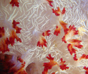 کیسه تنان (CNIDARIANS)